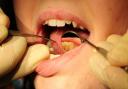 794 under-18s were on the waiting list for an NHS dentist in Powys. Photo credit: Rui Vieira/PA Wire.