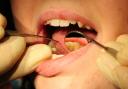 The number of people waiting for NHS dental treatment in Powys has now exceeded 5,000, according to figures provided by Powys Teaching Health Board this week. (Image: PA).