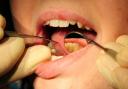 A new dental contract has been agreed in Brecon