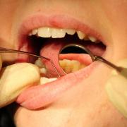 794 under-18s were on the waiting list for an NHS dentist in Powys. Photo credit: Rui Vieira/PA Wire.
